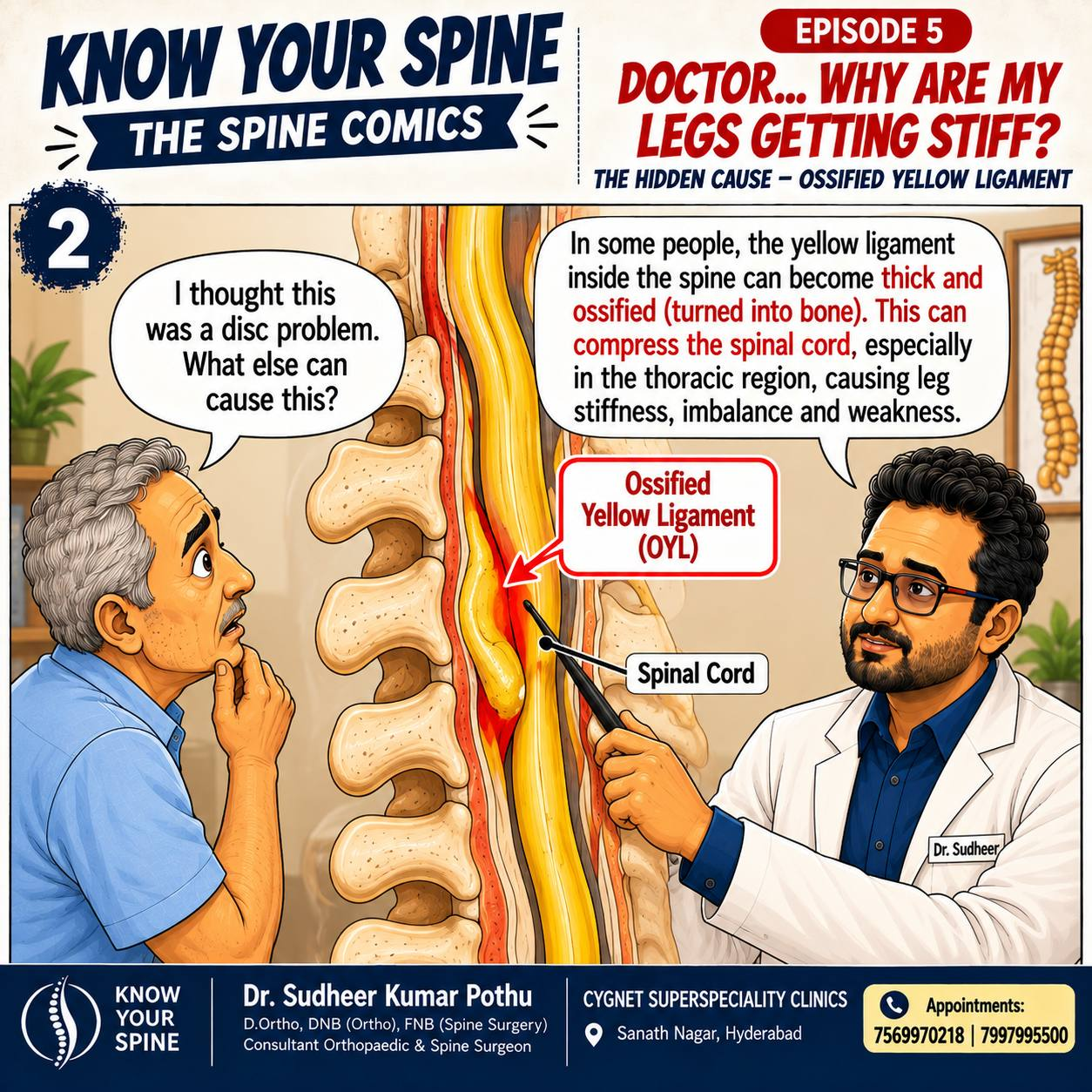 Illustration explaining ossification of the yellow ligament narrowing the thoracic spinal canal